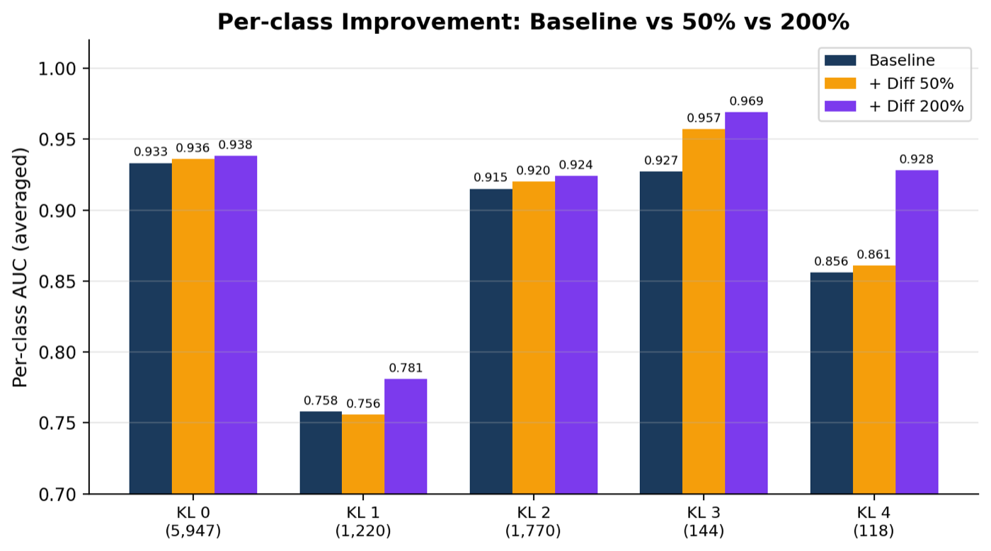 Per-class AUC at baseline versus 50% and 200% synthetic augmentation, with the largest gains at KL3 and KL4