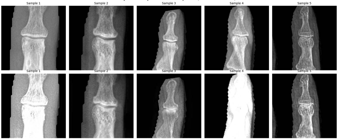 Top row of real hand X-rays compared with a bottom row of diffusion-generated X-rays